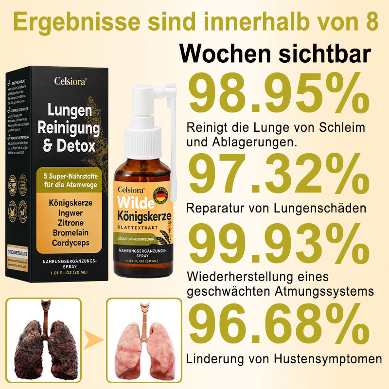 👩‍⚕️💖 Celsiora® Neues Königskerzen-Spray mit maximaler Wirkstärke (Hilft bei erschwertem Aushusten, Atemnot, übermäßiger Schleimbildung und Lungeninfektionen)