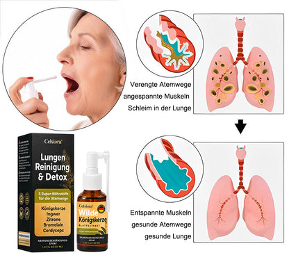 👩‍⚕️💖 Celsiora® Neues Königskerzen-Spray mit maximaler Wirkstärke (Hilft bei erschwertem Aushusten, Atemnot, übermäßiger Schleimbildung und Lungeninfektionen)